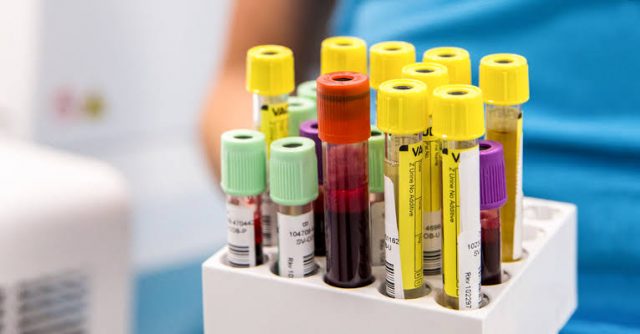 The Freedom To Order Your Blood Test